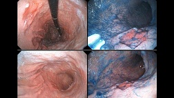 Клинический случай МегаМарофон 2025.